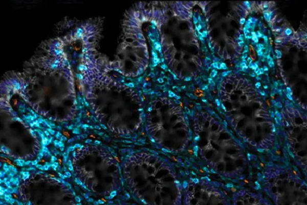 Вчені знайшли спосіб допомогти старіючій кишківнику відновитися