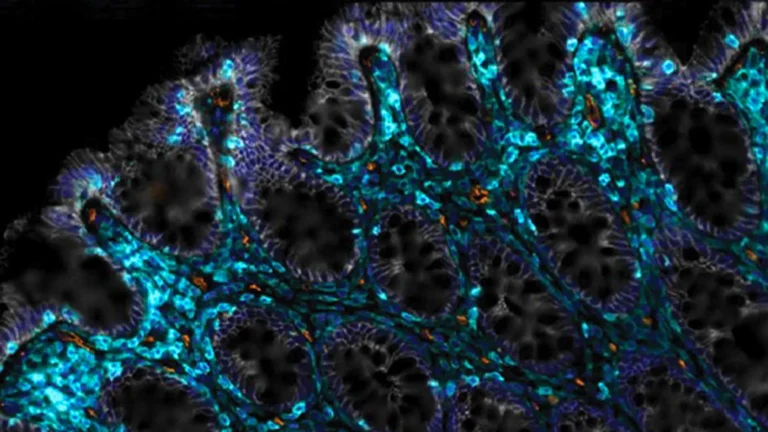 Вчені знайшли спосіб допомогти старіючій кишківнику відновитися