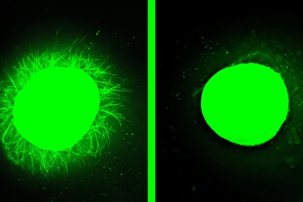 Вирощений в лабораторії спинний мозок людини заживає після травми в результаті значного прориву