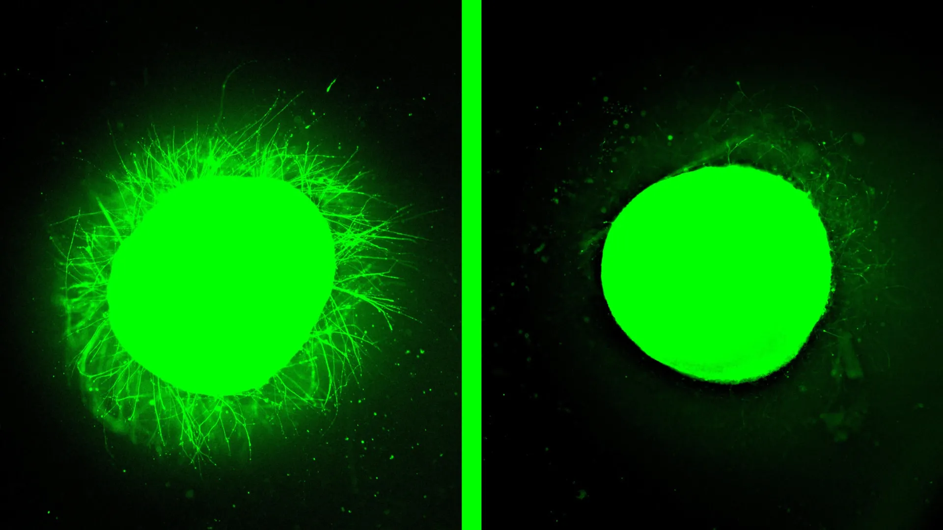 Вирощений в лабораторії спинний мозок людини заживає після травми в результаті значного прориву